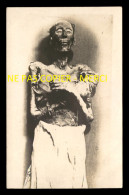 EGYPTE - MOMIE OPPRESSION - CARTE PHOTO ORIGINALE - Afrique