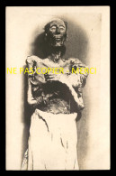 EGYPTE - MOMIE OPPRESSION - CARTE PHOTO ORIGINALE - Afrika