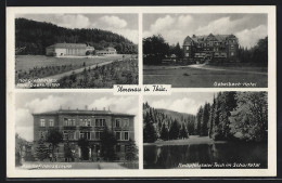 AK Ilmenau, Kongresshalle Und Parkgaststätten, Gabelbach-Hotel, Reichsfinanzschule, Knöpfelstaler Teich  - Ilmenau