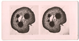 Stereo-Fotografie Makroaufnahme, Mikroskopische Vergrösserung, Medizin, Biologie  - Photos Stéréoscopiques