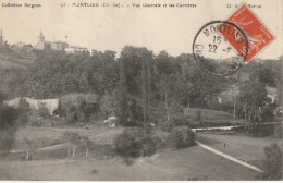 XXX -(17) MONTLIEU - VUE GENERALE ET LES CARRIERES - 2 SCANS - Otros & Sin Clasificación