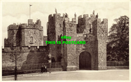 R588591 Barbican. Alnwick Castle. 15670. Valentines Phototype Postcards - Mondo