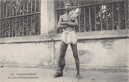 India - PUDUCHERRY Pondichéry - A Case Of Elephanthiasis - Inde