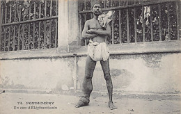 India - PUDUCHERRY Pondichéry - Elephanthiasis - Publ. Messageries Maritimes 74 - Inde