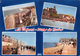 76 LE TREPORT Et Mers Les Bains Multivue  IRIS  (scanR/V)   N° 40  MR8007 - Le Treport