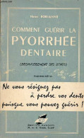 Comment Guérir La Pyorrhée Dentaire (déchaussement Des Dents) - Ses Origines, Ses Causes, Son Traitement, Sa Guérison - - Santé