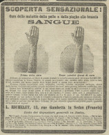 Cura Delle Malattie Della Pelle  RICHELET - Pubblicità 1910 - Advertising - Reclame