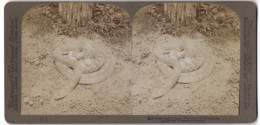 Stereo-Fotografie Underwood & Underwood, New York, Schlange Bullennatter Schütz Ihr Gelege  - Stereoscopic