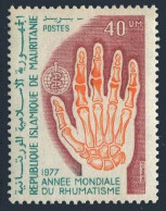 Mauritania 366,MNH.Michel 574. World Rheumatism Year, 1977. X-ray Of Hand. - Mauritanië (1960-...)