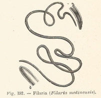 Filaria Medinensis - Incisione Antica Del 1926 - Engraving - Stiche & Gravuren