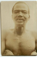 Afrique - Divers - RPPC - Portrait D'un Homme - Scarifications - Non Classés