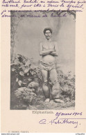 TAHITI En 1906 / ELEPHANTIASIS Par F. HOMES - Tahiti