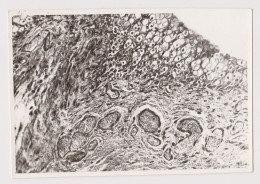 Pattern, Sample Microscope Photo, Odd Abstract Surreal Vintage Orig Photo 12.8x8.8cm. (68546) - Oggetti