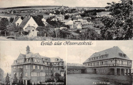 Hermeskeil Panorama Krankenhaus Jugendherberge Gl1955? #152.103 - Autres & Non Classés