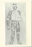 Tableau De Paterson Ewen - L'homme Aux Bandages - Peintures & Tableaux