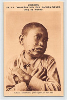 Hawaii - MOLOKAI - Leper Colony - Keliiahonoui, A 7-year-old Leper - Publ. Missions Of The Congregation Of The Sacred He - Molokai