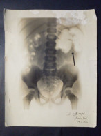 Radiographie Pelvienne. - Other Apparatus