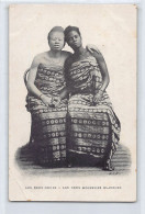 Ghana - The Two Sisters - Albino Womana And Her Sister - Publ. Unknown - Ghana - Gold Coast