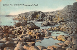 Delcampe - A030 Ireland General View Of Giant;s Causeway Portrush Vintage Postcard - Altri & Non Classificati