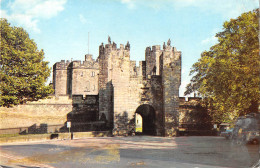 Delcampe - Uk9462 The Barbican Alnwick  Uk - Sonstige & Ohne Zuordnung